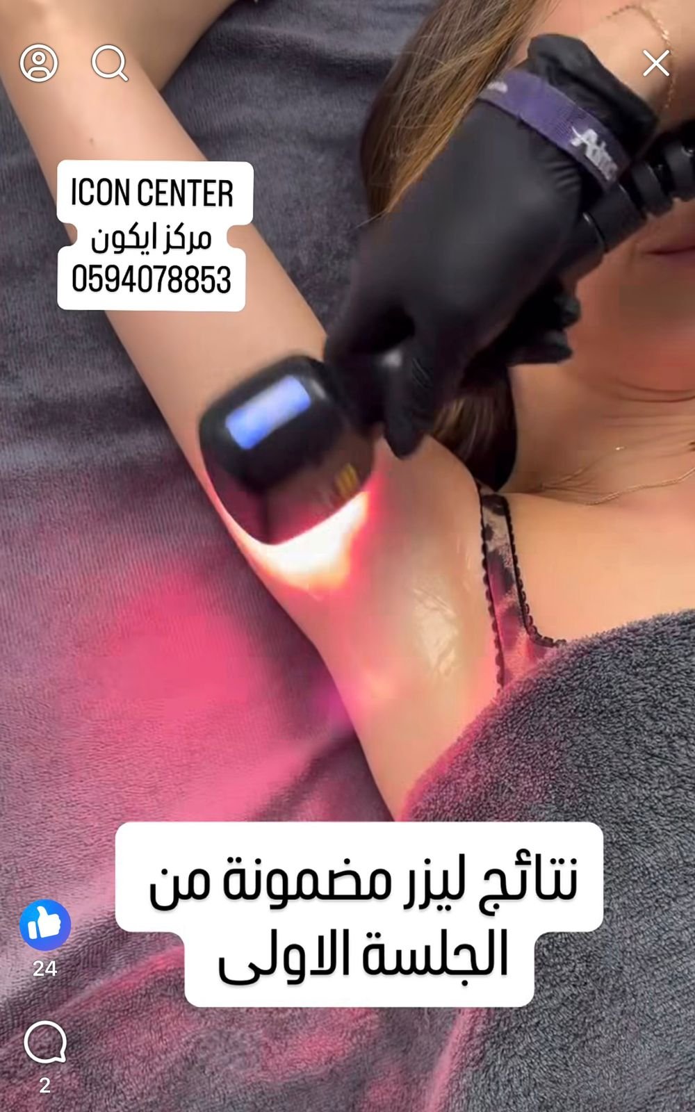 نتائج مضمونة - ليزر ازالة الشعر