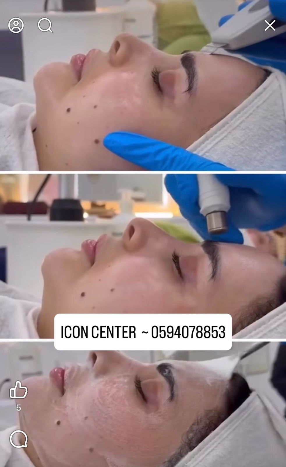 تنظيف البشرة الطبي