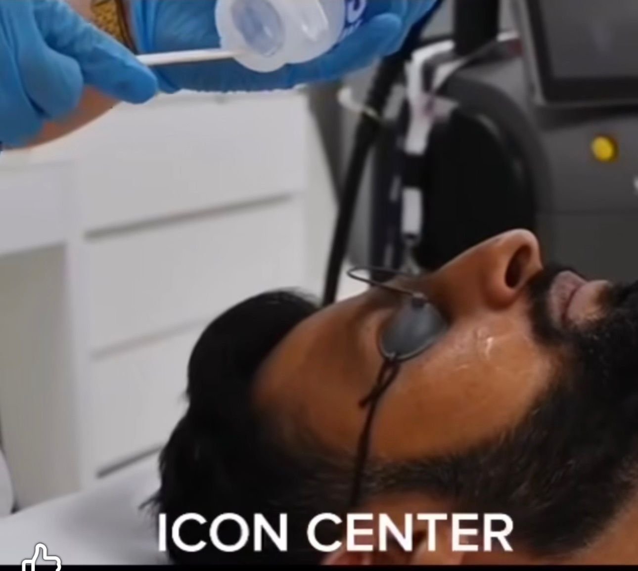 تحديد اللحية بالليزر